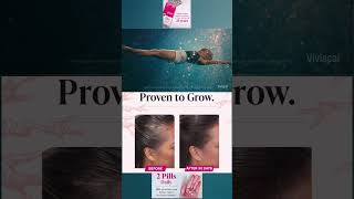 USD 2799  Viviscal Hair Growth Supplements for Women to Grow Thicker [upl. by Nerol306]