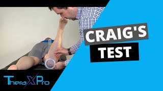 Craigs Test  Femoral Anteversion  Femoral Retroversion [upl. by Eerdna]