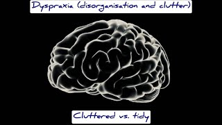 Dyspraxia disorganisation and clutter realistic example [upl. by Press]