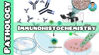 Immunohistochemistry  Pathology  USMLE NCLEX [upl. by Aneeroc]