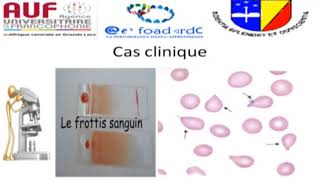 MORPHOLOGIE EN HEMATOLOGIE EPISODE 5 [upl. by Lyrrehs]