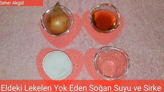 Güneş Lekeleri ve Yaşlılık Lekelerine Soğan Suyuyla Kesin Çözüm [upl. by Bresee]