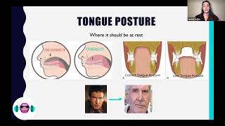 Correct Tongue Posture Why correct tongue posture affects your whole face including your teeth [upl. by Kawai]