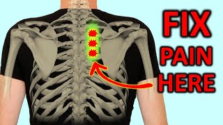 quotRhomboid Painquot How To Fix Shoulder Blade Pain Quickly [upl. by Bein]