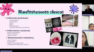 NOCARDIA MICROBIOLOGIA CES [upl. by Elam]