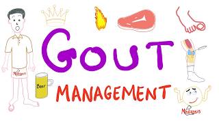 Gout Management [upl. by Nimaynib]