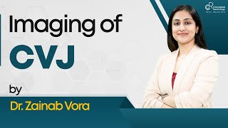 Imaging of CVJ by DrZainab Vora [upl. by Bunde]