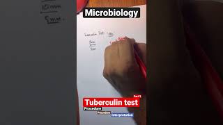 mantoux testTUBERCULIN TEST mantoux test positive mantoux test in hindi mantoux test in hindi [upl. by Gallager602]