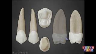 segundo premolar superior anatomia [upl. by Lisha]