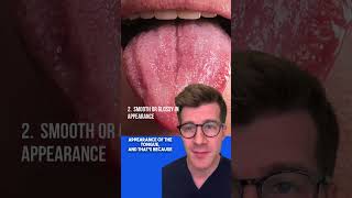 Signs of IRON DEFICIENCY ANAEMIA in the TONGUE  Glossitis explained shorts health anaemia [upl. by Atiugram]