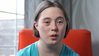 Down Syndrome Answers What is trisomy 21 [upl. by Einreb831]