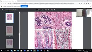 Connective Tissue Proper Histology Summarized [upl. by Aihsilef]