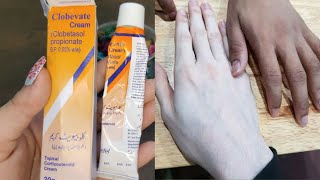 Clobevate cream for whiteninghand and foot whitening cream clobevate cream [upl. by Ayotan]