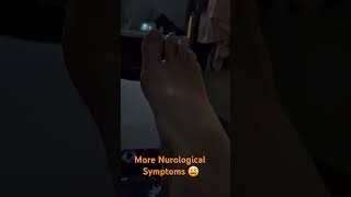 Living with painful Spasms Primary Lateral sclerosis 🦋 [upl. by Nam63]