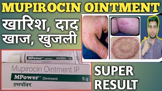 Mupirocin Ointment Ip Use In Hindi  mpower Ointment Ip  Mupirocin Ointment Use SkinAllergy [upl. by Kirst]