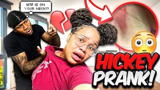 HICKEY PRANK ON BOYFRIEND ALMOST DIED  😵 [upl. by Henghold80]