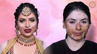 How to Cover सफेद दाग Vitiligo Leucoderma Makeup transformation  Makeup Tutorial pkmakeupstudio [upl. by Tlok]