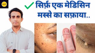 Best Medicine for warts  चेहरे के मस्सेगर्दन के मस्से DrJamil Ahmed Shah [upl. by Anahsed996]