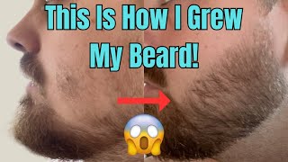 This Is How I Grew My Beard With Minoxidil And a Derma Stamp [upl. by Drye]