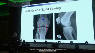 Application of Stem Cells in Orthopaedic Surgery Dr Khay Yong Saw subtitled [upl. by Aoket]