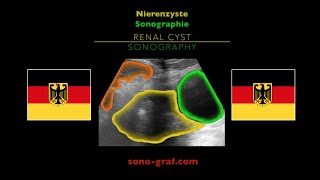 Sonographie  Nierenzyste [upl. by Koppel]