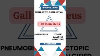 Riglers Triad Key Signs of Gallstone Ileus Explained gallbladderproblems MedicalEducation [upl. by Alyahc]