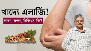 খাদ্য বা ফুড এলার্জির কারণ লক্ষণ ও চিকিৎসা  Food allergy Causes Symptoms amp Treatment in Bangla [upl. by Nas749]