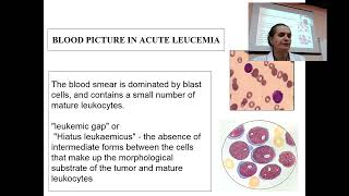 About Leucaemia in 6 minutes from prof Maksimovich Nataliya [upl. by Amando978]