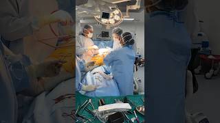 Operation theatre videoHip replacement Stem implantation with no touch technique doctor surgeon [upl. by Yeliw]