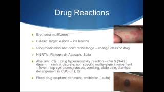 Dermatology in HIV  Nancy Rihana MD [upl. by Kahle]