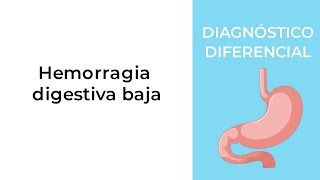 Diagnóstico Diferencial Hemorragia digestiva baja [upl. by Darya]