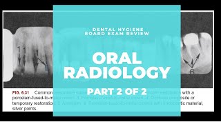 NBDHE  DENTAL HYGIENE BOARD EXAM REVIEW Everything you need to know about RadiographyPart 2 of 2 [upl. by Okia]