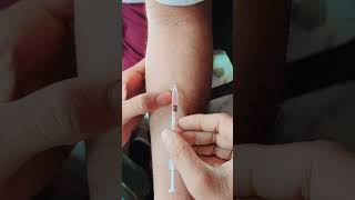 mantoux test kese lagaye [upl. by Ardolino293]