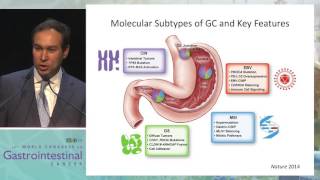 Keynote Lecture 1 Unraveling the taxonomy in gastric cancer [upl. by Ellesig]