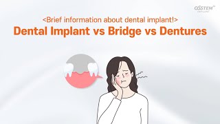 Dental Implant vs Bridge vs Dentures [upl. by Naryk]