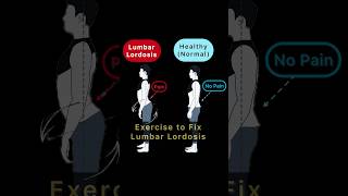 Exercise to fix Lumbar Lordosis Correct Lumbar Lordosis Posture [upl. by Utir770]