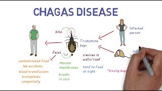 Chagas Disease  An overview [upl. by Leugimesoj]