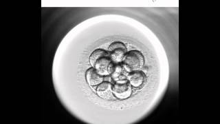 Embryoscope 2  Nuevo método de cultivo y selección embrionaria [upl. by Naik]