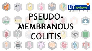 Pseudomembranous Colitis [upl. by Riaj746]