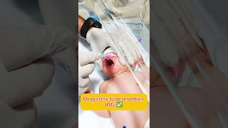 Orogastric tube insertion Nursing process hospital nursing medical trending ytshorts youtube [upl. by Akcirahs]