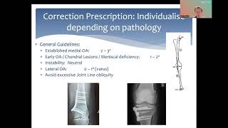 Periarticular Osteotomy for Knee Pathology  Indications Techniques amp Outcomes Dr David Parker [upl. by Bernita]