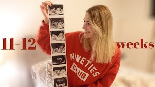 12 WEEKS PREGNANT WITH BABY 2 12 Week NHS Dating Scan UK amp First Trimester Vlog 👶✨ [upl. by Orten86]