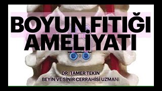 Boyun fıtığı ameliyatı [upl. by Halima]