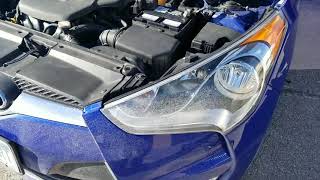 HYUNDAI CAR BATTERY REPLACEMENT [upl. by Etirugram]