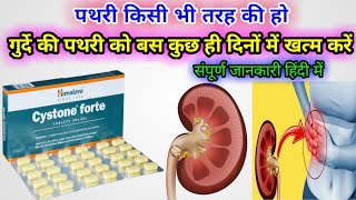 Cystone Forte Tablet  पथरी निकालने की सबसे असरदार दवा  Uses side effects How to use full review [upl. by Buyse758]