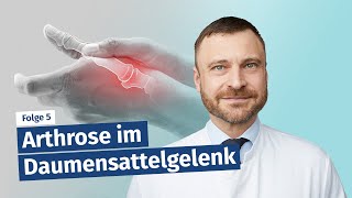 Arthrose im Daumensattelgelenk Rhizarthrose [upl. by Dinsdale]