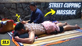 ASMR  Street cupping massage  35 Amazing Up to 100 cups on your back  Great for colds and flu [upl. by Lacsap834]