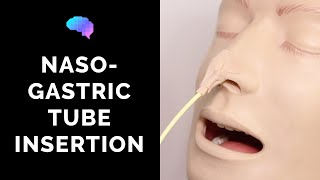 Nasogastric NG Tube Insertion  OSCE Guide  UKMLA  CPSA [upl. by Yokum]