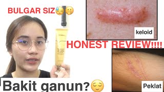 LANBENA TCM SCAR REMOVER HONEST REVIEW MABISA BA [upl. by Avah]