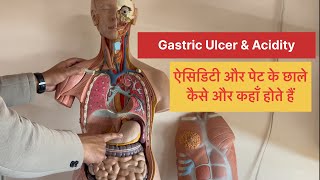 Full Video➡️Gastric Ulcer amp Acidity in Stomach कैसे और कहाँ होता है DigestiveSystem viral trending [upl. by Adyol]